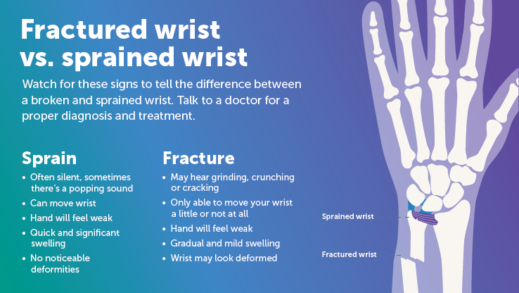 How to tell if wrist is broken or sprained