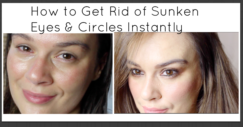 How to get rid of sunken eyes