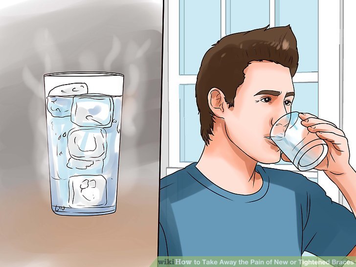 How to ease braces pain