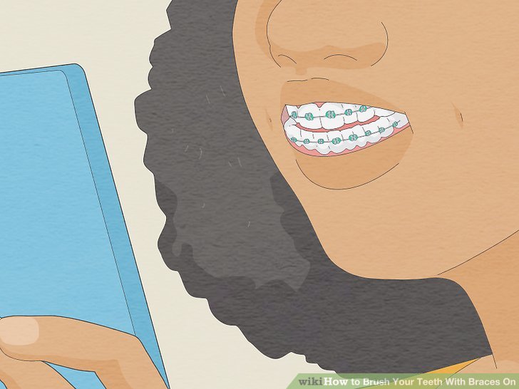 How to brush your teeth with braces