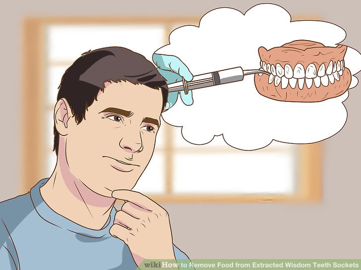 How to remove food from teeth