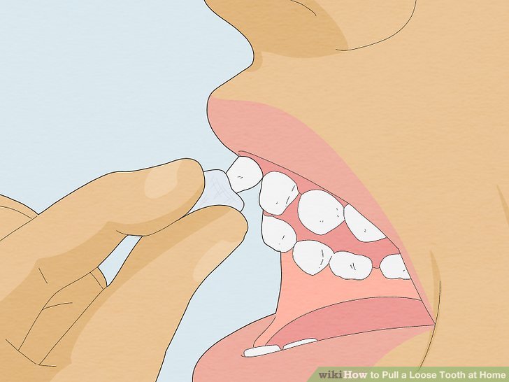 How to remove a tooth at home