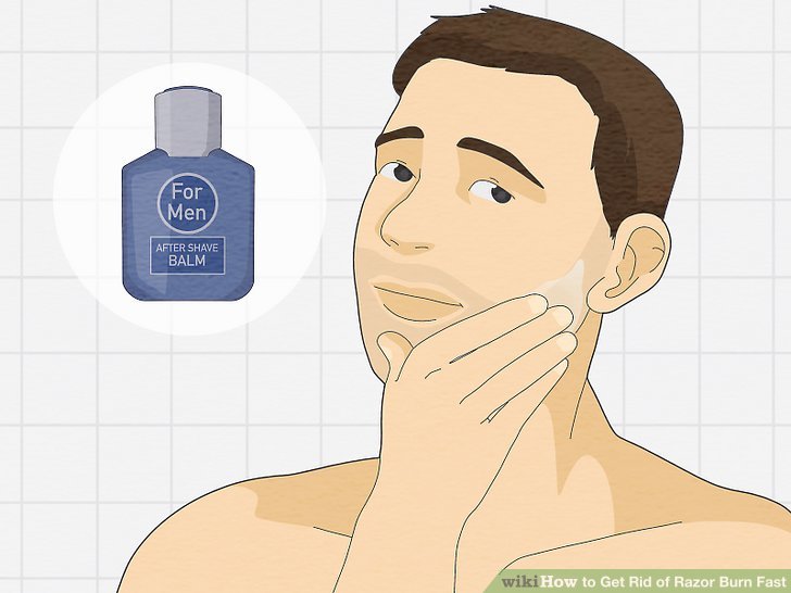 How to get rid of razor burn