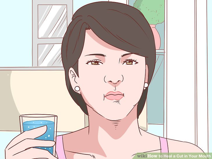 How to heal a cut in your mouth overnight