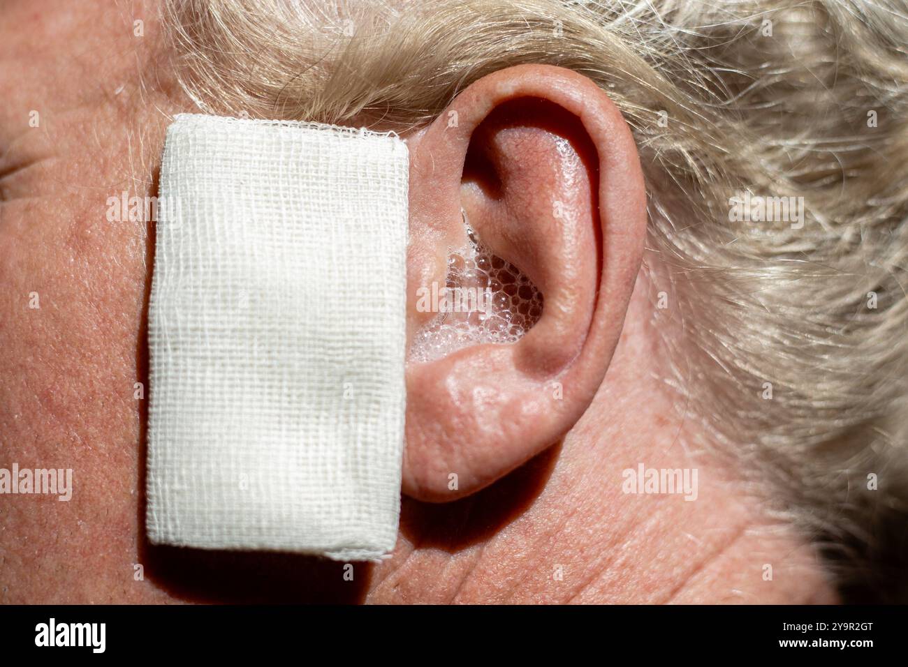 How long to leave hydrogen peroxide in ear