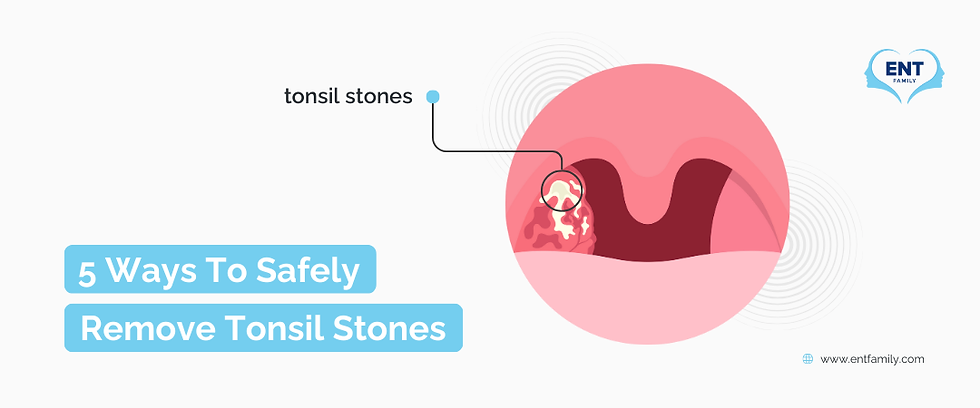 How to get tonsil stones out